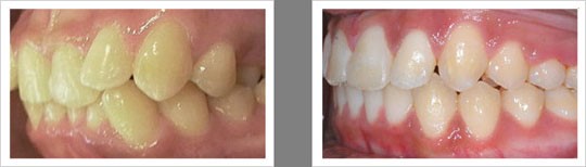 Case 2 – Spacing