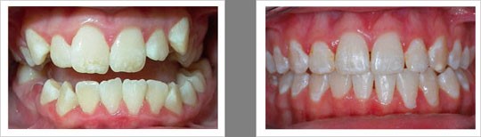 Case 13 – Adult Surgical Case